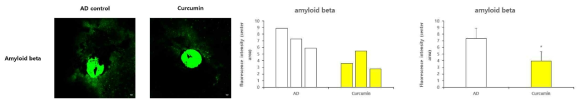 이미징 시행 후 sacrifice 한 AD Tg mouse와 curcumin을 3개월간 경구투여한 AD Tg mouse의 망막에서 amyloid beta를 검출한 immunofluorescence 결과와 형광 Intensity를 정량한 그래프. 이미징에서 중점적으로 보았던 시신경부위 주변으로 같은 배율을 이용하여 confocal로 촬영함