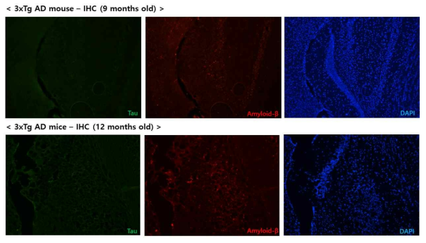 9, 12개월령 3x Tg mouse의 brain 내의 Tau와 Aβ의 차이를 확인 한 immunofluorescence 결과