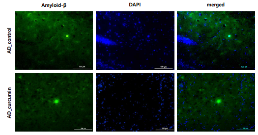 12개월령 AD Tg mouse 대조군(위)과 curcumin을 3개월간 경구투여한 동일 월령 AD Tg mouse(아래)의 brain 내 Aβ에 유의한 차이가 보이지 않음