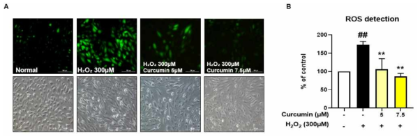 H₂O₂에 의한 산화 손상을 받은 ARPE-19 세포에서 curcumin 5, 7.5μM의 보호 효과를 ROS 측정 실험으로 확인한 결과. H₂O₂에 의해 증가된 ROS 형광 신호가 커큐민 전처리 군에서는 확연히 감소되어 있음