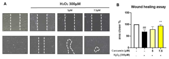 H₂O₂에 의한 산화 손상을 받은 ARPE-19 세포에서 curcumin 5, 7.5μM의 보호 효과를 세포분열능 확인 실험(wound healing assay)으로 확인한 결과