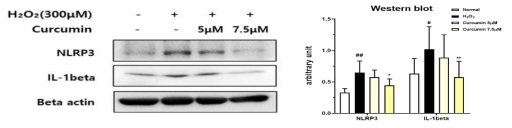 H₂O₂에 의한 산화 손상을 받은 ARPE-19 세포에서 curcumin 5, 7.5μM에 의한 Inflammasome pathway (NLRP3, IL-1beta)의 발현 변화를 western blot으로 확인 한 결과