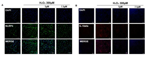 H₂O₂에 의한 산화 손상을 받은 ARPE-19 세포에서 curcumin 5, 7.5μM에 의한 Inflammasome pathway (NLRP3, IL-1beta)의 발현 변화를 Immunocytochemistry로 확인 한 결과