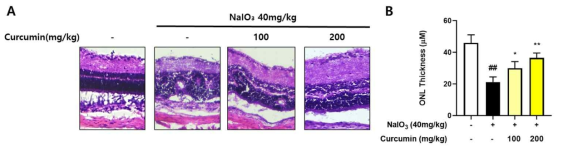 Sodium iodate에 의한 산화 손상을 유발한 망막변성 동물 모델의 망막에서 curcumin (100mg/Kg, 200mg/Kg) 투여에 따른 outer retinal layer (ONL) 두께 차이를 확인한 결과