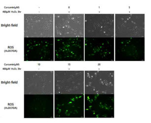 RPE 세포 망막변성 모델에서 커큐민의 농도별 처리 시 Oxidative stress 마커인 ROS 검출 결과