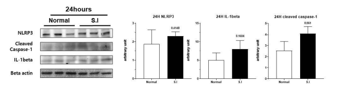 Sodium iodate에 의한 산화 손상을 유발한 망막변성 동물 모델(SD rat)의 망막 조직에서 Inflammasome pathway (NLRP3, IL-1beta)의 발현 차이