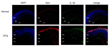AD mouse 모델인 3xTg mouse의 망막에서 염증인자의 발현 차이