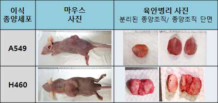 이식 종양세포 차이에 따른 종양 조직의 육안 병리 비교