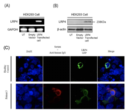 LRP4항체 측정 cell based assay. (A) LRP4를 transfection한 HEK293세포에서 LRP4 mRNA의 발현을 rt-PCR로 확인함. (B) LRP4를 transfection한 HEK293세포에서 LRP4 protein의 발현을 western blot으로 확인함. (C) LRP4를 transfection한 HEK293세포에 중증근무력증환자와 건강인의 혈청을 적용하여 LRP4항체 양성 중증근무력증 환자의 혈청을 적용하였을 때 LRP4의 발현위치(녹색형광)와 LRP4항체(적색형광)이 위치가 일치함을 확인하여 LRP4항체 양성을 확인함