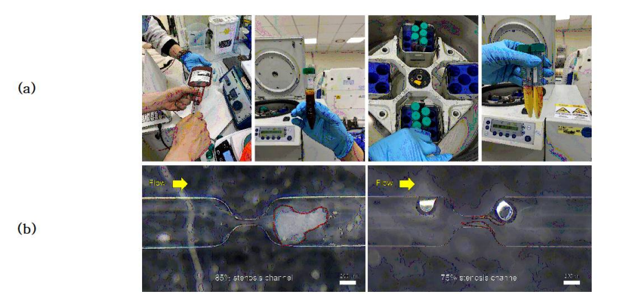 PRP를 사용한 혈액 실험: (a) PRP 제작과정, (b) 협착 정도에 따른 혈전 형성