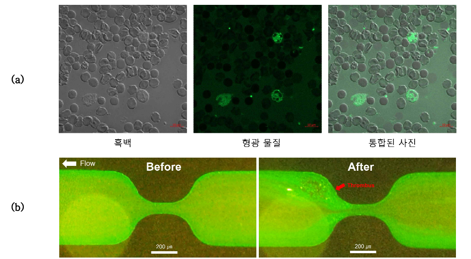 형광 물질을 통한 혈전 가시화: (a) 정적 상태에서 공초점 현미경을 통한 혈액 내 혈전 확인, (b) 동적 환경에서 형광현미경을 통한 혈전 형성 과정 관찰