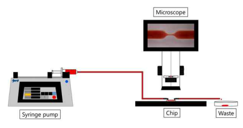 칩 내 혈전형성 관찰을 위한 셋업 개략도