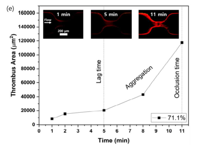 이미지 분석 기법을 통하여 확인된 혈전 형성 3단계 (lag time, aggregation, occlusion)