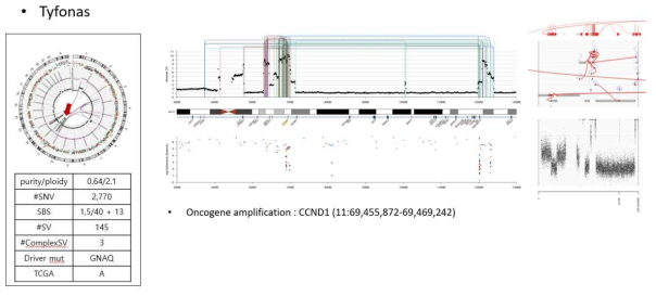 chromosome 11번에서 확인되는 Tyfonas의 예시 및 이로 인한 CCND1 유전자 증폭