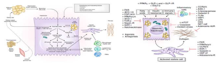 비알콜성 지방간염의 진행 기전 및 약물치료 타겟