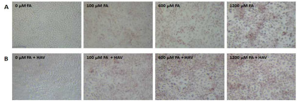 지방산 및 간염 A형 바이러스 처리에 따른 oil red O 염색 결과 A. 지방산 처리구 B. 지방산 및 간염 A형 바이러스 처리구