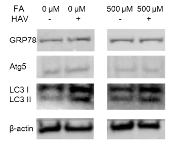 지방산 처리 및 간염 A형 바이러스 감염에 의한 autophage 인자 발현 비교