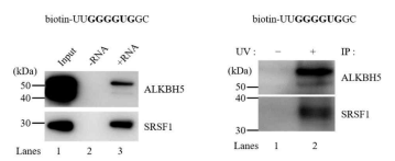 RNA pulldown assay 및 UV-crosslinking assay를 통한 단백질·RNA 결합 확인