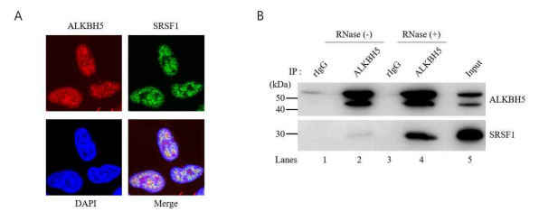 ALKBH5 및 SRSF1의 세포 내 위치 및 단백질 상호작용 확인