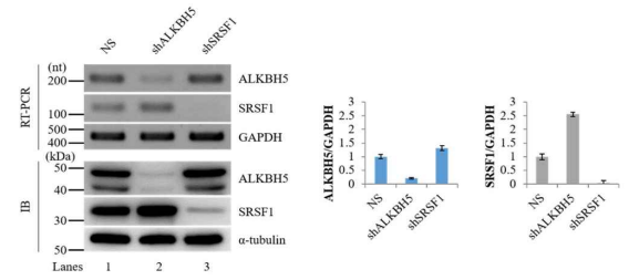 ALKBH5 및 SRSF1 사이 발현 상관관계 확인