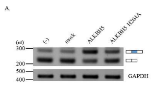 RT-PCR을 통한 ALKBH5와 mut. ALKBH5 H203A splicing 확인