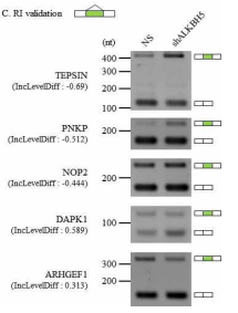 ALKBH5 KD 세포에서 RI events의 validation