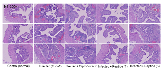 대조군과 4개 실험군의 방광조직의 HE staining 결과에서 염증 반응 관련 세포들의 침윤 (원으로 표시)