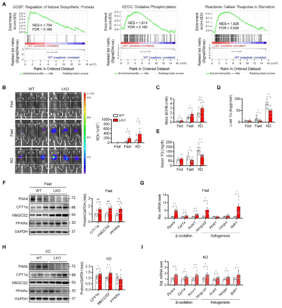 PAK4 KO 마우스 간 조직을 사용한 RNA-Seq 결과(A). KO 마우스에서 케톤생성이 증가하고 간 지방축적은 감소하였음(B-I)