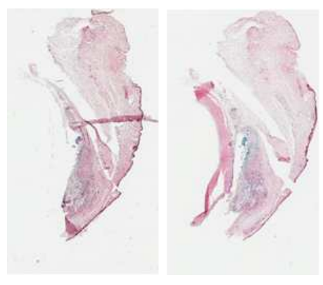 AAV에 의한 b-galactosidase의 발현. 좌) naked AAV; 우) alginate hydrogel-associated AAV