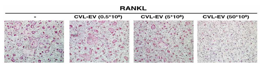 세포외소포체에 대한 파골세포 분화 억제 (TRAP staining)