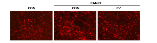 세포외소포체에 대한 파골세포의 F-actin ring 형성 억제 평가 (F-actin ring 염색)