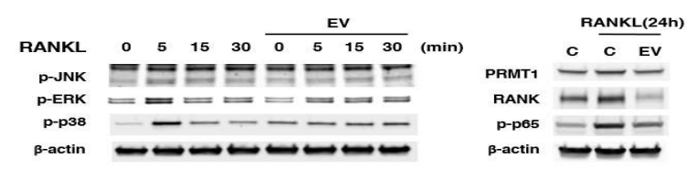 세포외소포체의 파골세포 분화 관련 단백질 조절 효과 (좌: NTA/ 우: TEM)