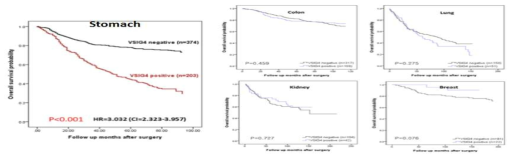 다양한 암 환자의 생존기간과 VSIG4의 연관성(사전연구결과)