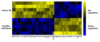 활동성 결핵군과 정상 대조군 간의 mRNA sequencing 분석을 기반으로 한 heat map 분석