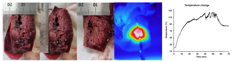 적출된 돼지 간에서 고주파 소작용 스텐트의 발열 평가