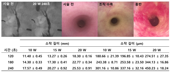 높은 조건에서 담도조영술 및 내시경 소견과 조건 별 소작 범위 전임상 데이터