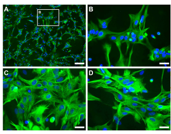 Immunocytofluorescence staining for GFAP and DAPI in rat cortical primary astrocytes. (A and B) GFAP-positive astrocytes are disperded in monolayer. Most (>95%) of cells are immunopositive with GFAP and DAPI. Scale bar, 200 μm in A, 50 μm in B-D