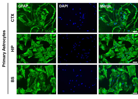흰쥐 대뇌피질(CTX), 해마(HIP), 뇌줄기(BS)에서 일차 배양한 성상교세포의 면역형광염색 (GFAP, 1:1000; scale bar=100μm)