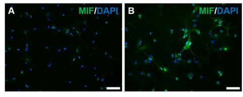 정상 배양조건 (A) 및 hypoxia 유도 후 (B) 해마 성상교세포 내 MIF의 발현. 일부 성상교세포에서 핵 내부에 존재하던 MIF가 세포체 및 가지돌기에서 현저히 증가함 (scale bar=100μm)