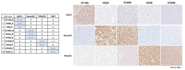 소세포폐암 세포주를 이용한 subtype IHC 염색조건 확립 및 WTS 결과와의 일치 확인