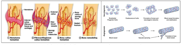 골재생 메커니즘(좌), vasculogenesis와 angiogenesis 비교