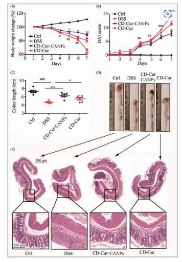 CD–Cur–CANPs ameliorated DSS-induced colitis.나노입자를 이용한 항암 기전 연구