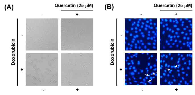 Quercetin의 doxorubicin 유도성 IMR-32 신경모세포종의 세포사멸에 대한 보호효과 (A) Light microscope. (B) Hochest satin result