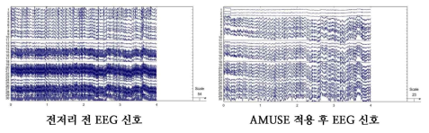 32개의 전극을 사용하여 수집한 알츠하이머 환자의 EEG 신호에 레퍼런스 전극 2개(Vertical EOG, Horizontal EOG)를 제외한 30개 전극 데이터에 AMUSE 알고리즘을 적용하여 정렬한 결과 알고리즘을 적용하기 전에 비해 노이즈와 아티팩트가 확연히 감소한 것을 볼 수 있음