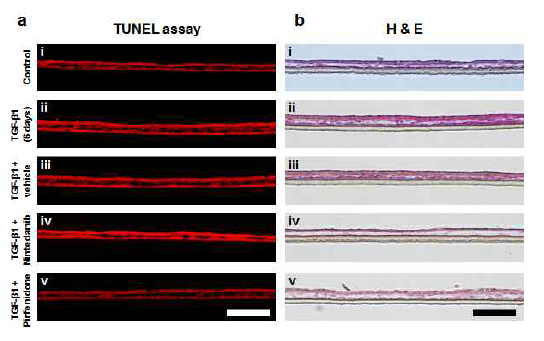 Histological analysis of PF induced and therapeutic treated tissues - Biomed Mater 2023