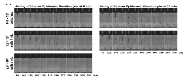 (Left) Initial jetting due to cell concentration (Right) Jetting after 10 min due to cell concentration - Bioprinting 2021