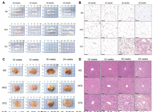 ND, HFD, 과 STZ 그룹에서 지방과 간 조직의 육안 구조와 조직학적 구조 비교. (A,B) EWAT (C,D) liver gross images and HE staining at 40x respectively