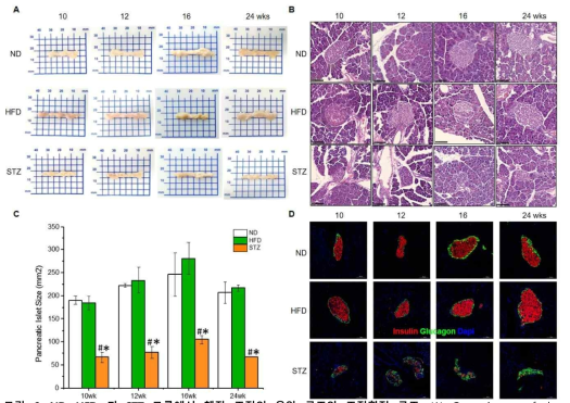 ND, HFD, 과 STZ 그룹에서 췌장 조직의 육안 구조와 조직학적 구조. (A) Gross image of the pancreas (B) H&E staining of the pancreatic islets (C) Pancreatic islet size (D) IF staining for insulin and glucagon in the pancreatic islets at 40x. *P < 0.05 vs ND, #P < 0.05 vs HFD