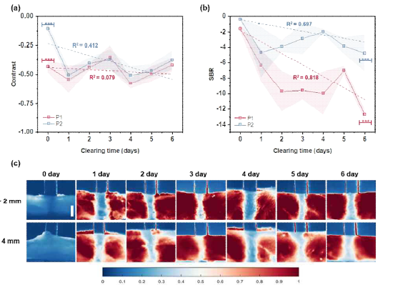 흡광도 이미징 모드에서 투명화 시간에 따른 (a) 대비 및 (b) SBR의 변화. p-값이 0.001 이하인 시리즈는 (***)로 표시됨. (c) 정규화된 척도에서 흡광도 이미징 하에서 모세관의 정성적 시각화. scale = 1 mm