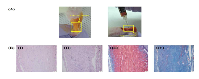 (A) 아킬레스건 및 collagenase type I (COL I) 주입 (B) H&E 염색 (I and II) Trichrome 염색 (III and IV). Normal tissue (I and III) and Achilles tendinitis (II and IV)